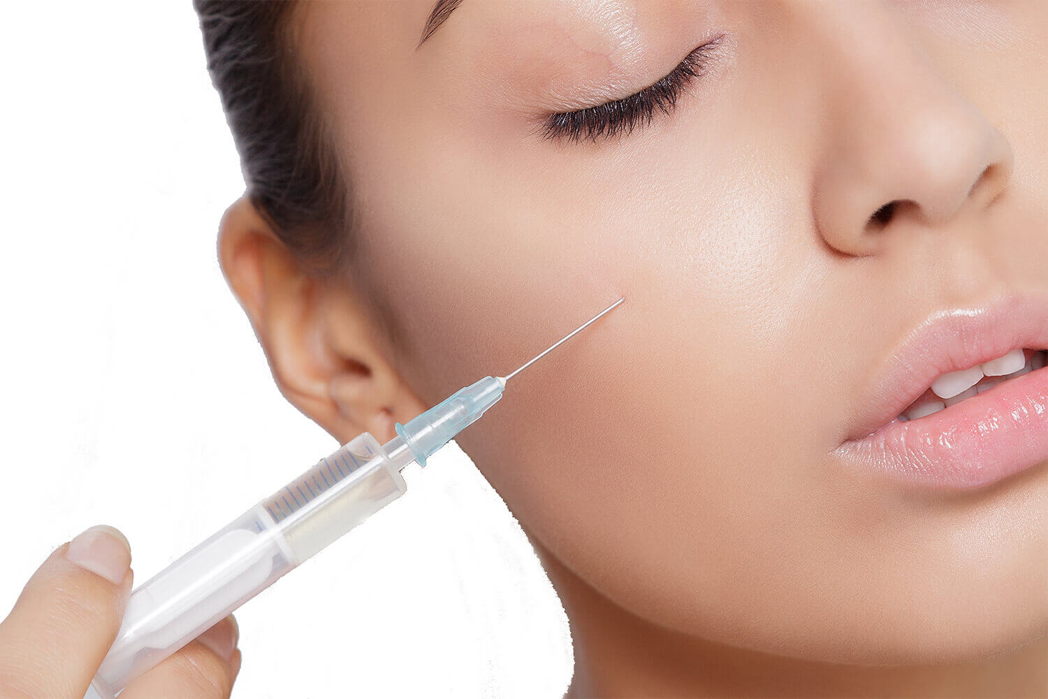 Botox Terapija izravnavanja mimičnih bora